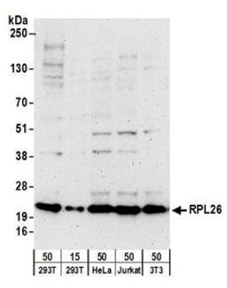 Detection of human and mouse RPL26 by western blot.