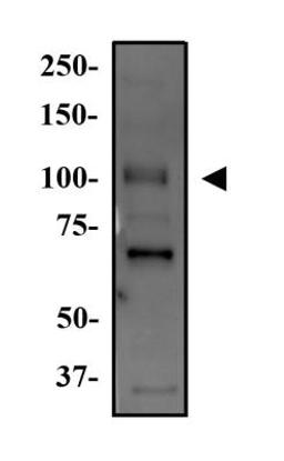 Western Blot: WNK4 Antibody [NB600-284] - Western Blot Image of anti-WNK4. Whole cell protein from Hek293 was separated on a 7.5% gel by SDS-PAGE, transferred to PVDF membrane and blocked in 5% non-fat milk in TBST. The membrane was probed with 2.0 ug/ml anti-WNK4 in 1% milk and detected with an anti-rabbit HRP secondary antibody using chemiluminescence