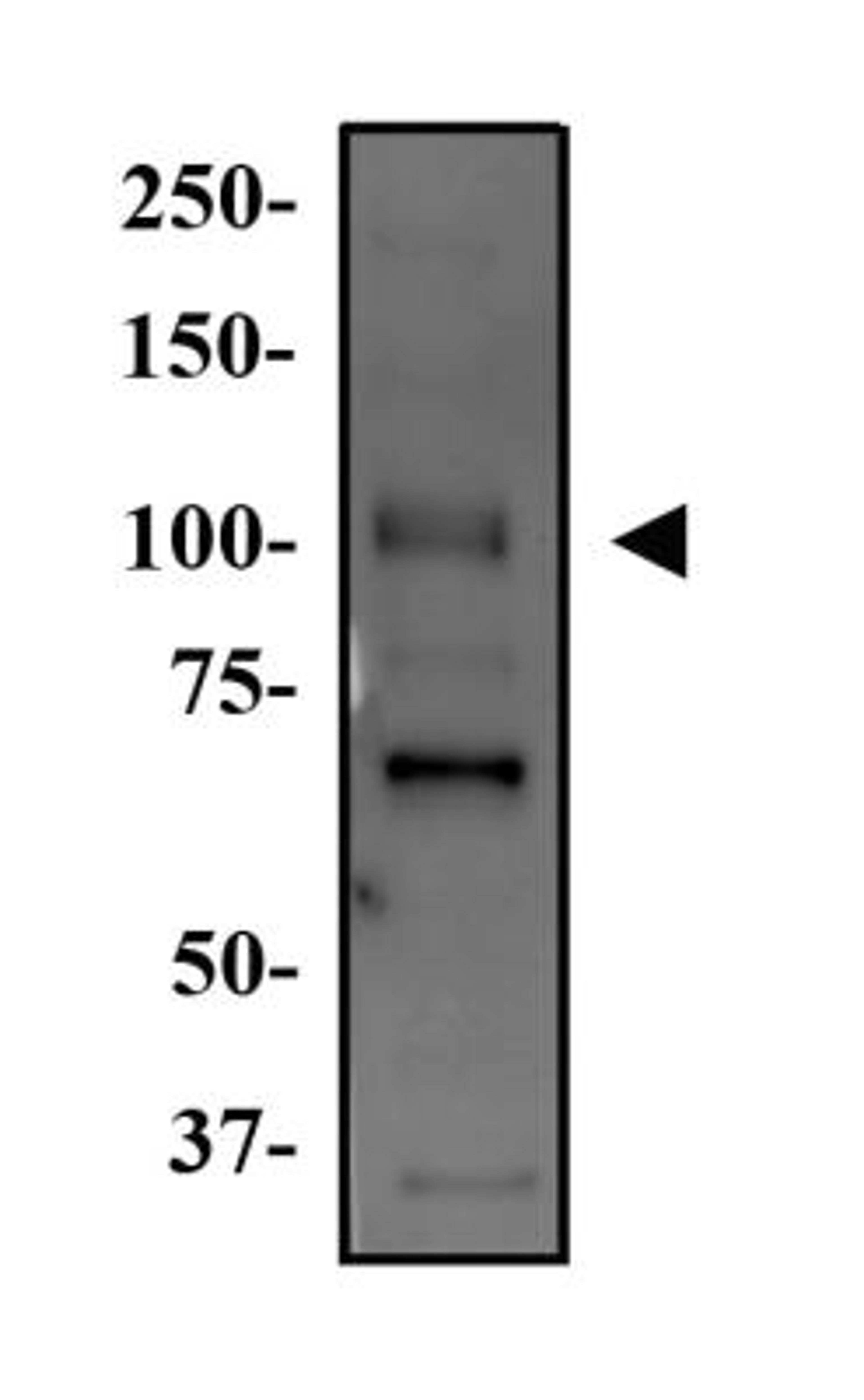 Western Blot: WNK4 Antibody [NB600-284] - Western Blot Image of anti-WNK4. Whole cell protein from Hek293 was separated on a 7.5% gel by SDS-PAGE, transferred to PVDF membrane and blocked in 5% non-fat milk in TBST. The membrane was probed with 2.0 ug/ml anti-WNK4 in 1% milk and detected with an anti-rabbit HRP secondary antibody using chemiluminescence