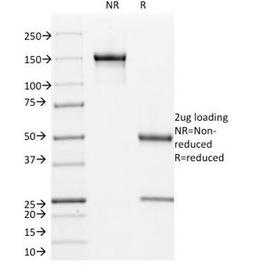 SDS-PAGE Analysis of Purified, BSA-Free L1CAM Antibody (clone UJ127). Confirmation of Integrity and Purity of the Antibody.