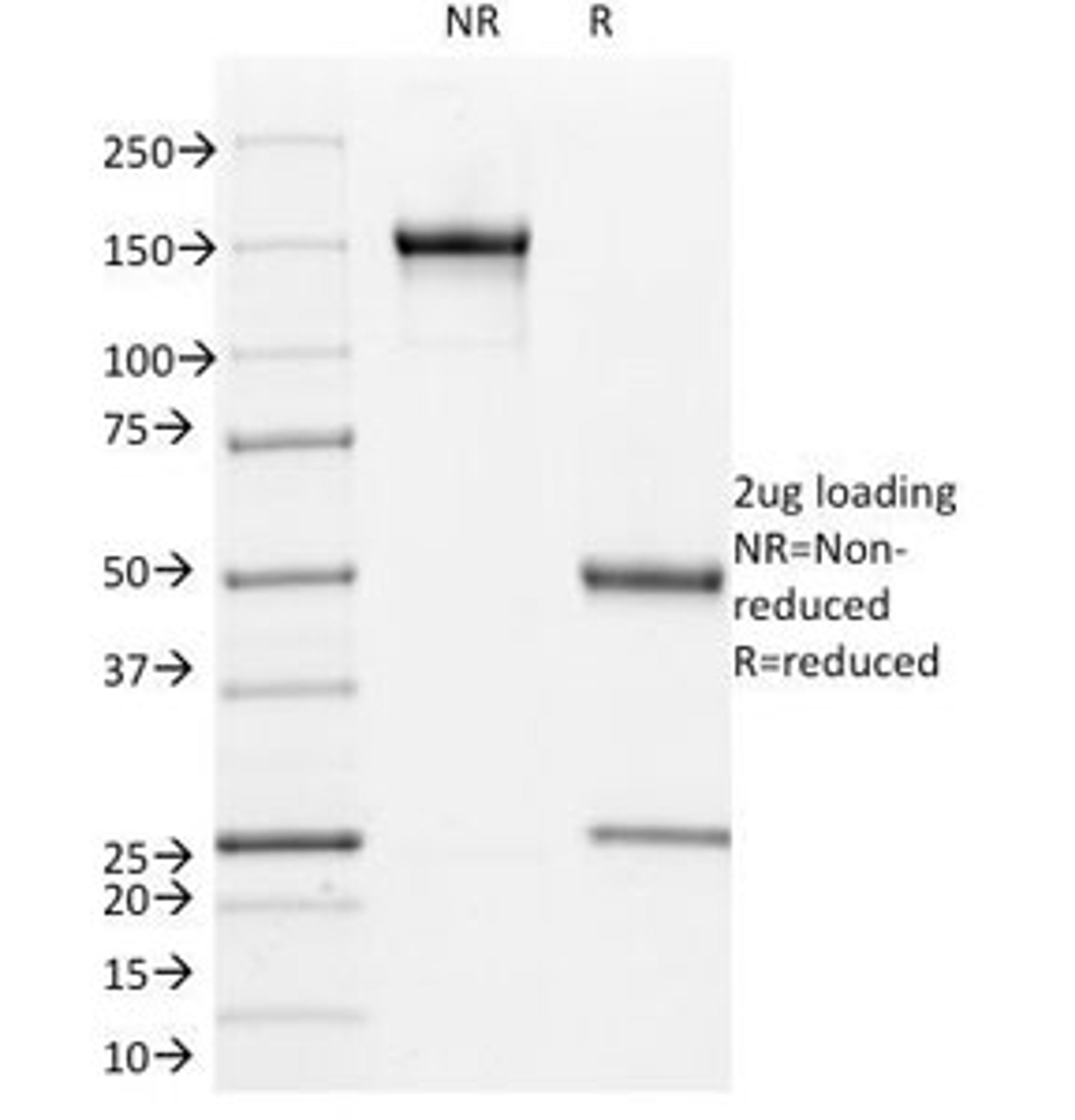 SDS-PAGE Analysis of Purified, BSA-Free L1CAM Antibody (clone UJ127). Confirmation of Integrity and Purity of the Antibody.