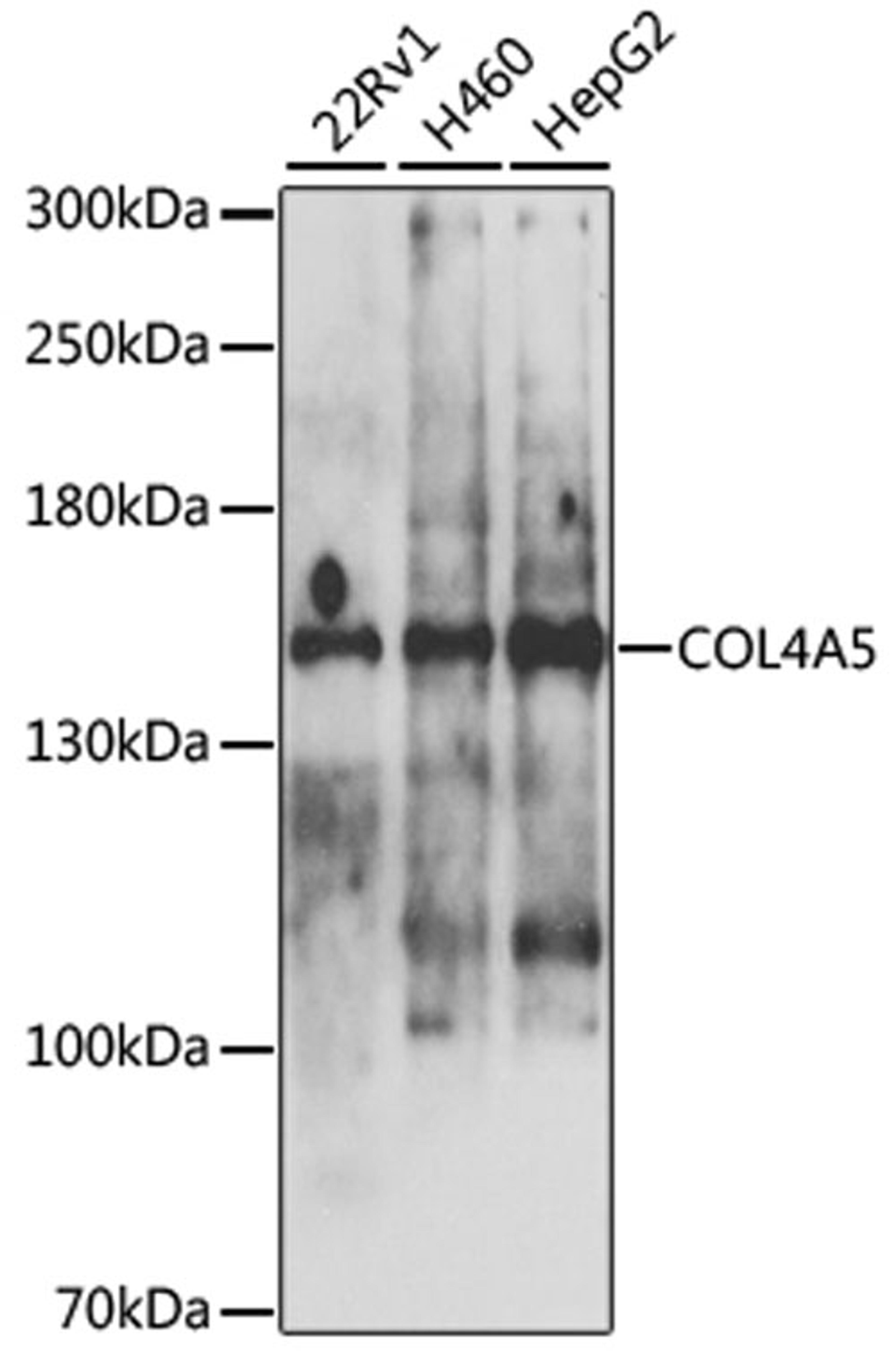 Western blot - COL4A5 antibody (A9809)