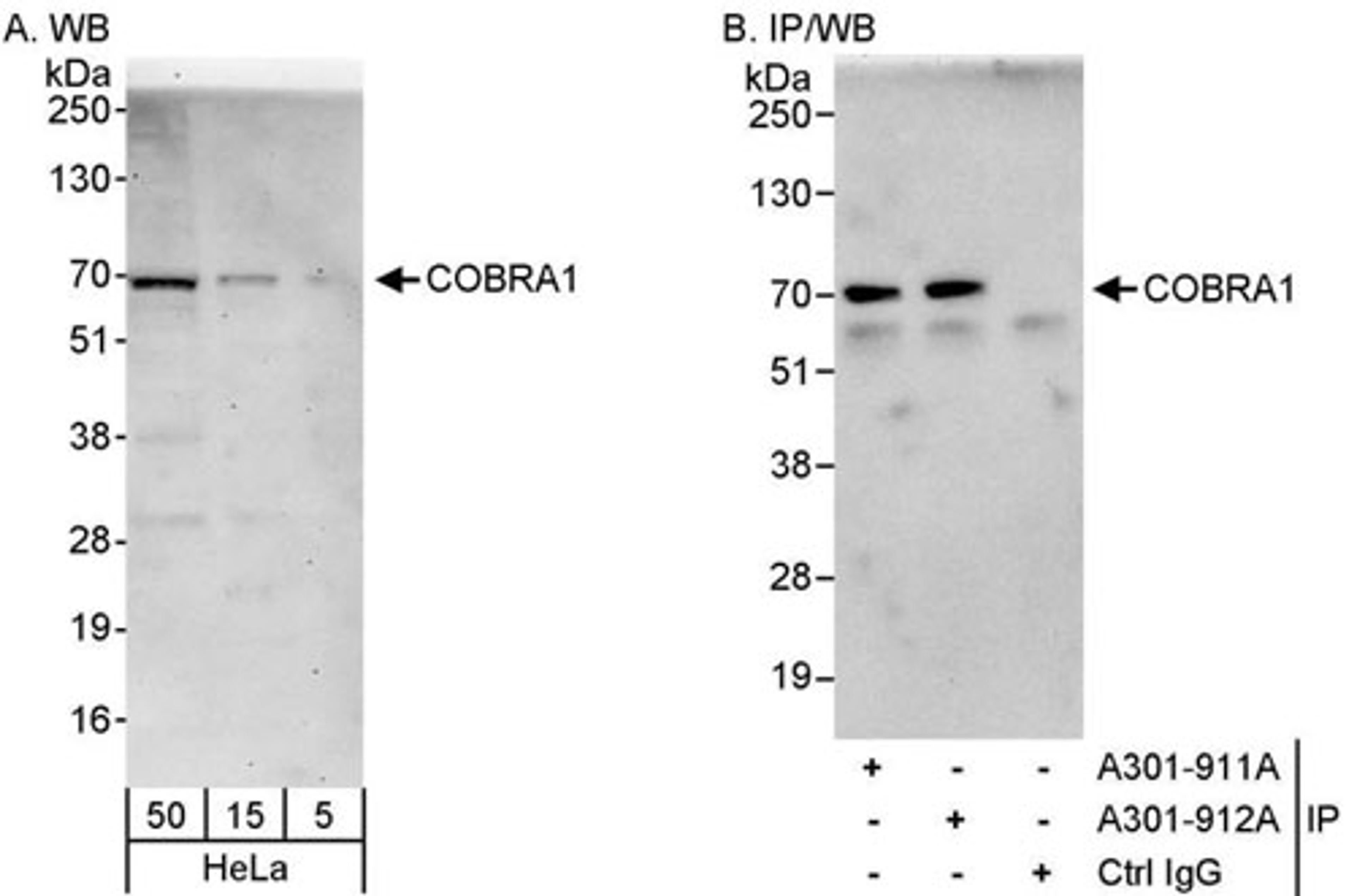 Detection of human COBRA1 by WB and IP.