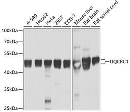 Western blot - UQCRC1 antibody (A3339)
