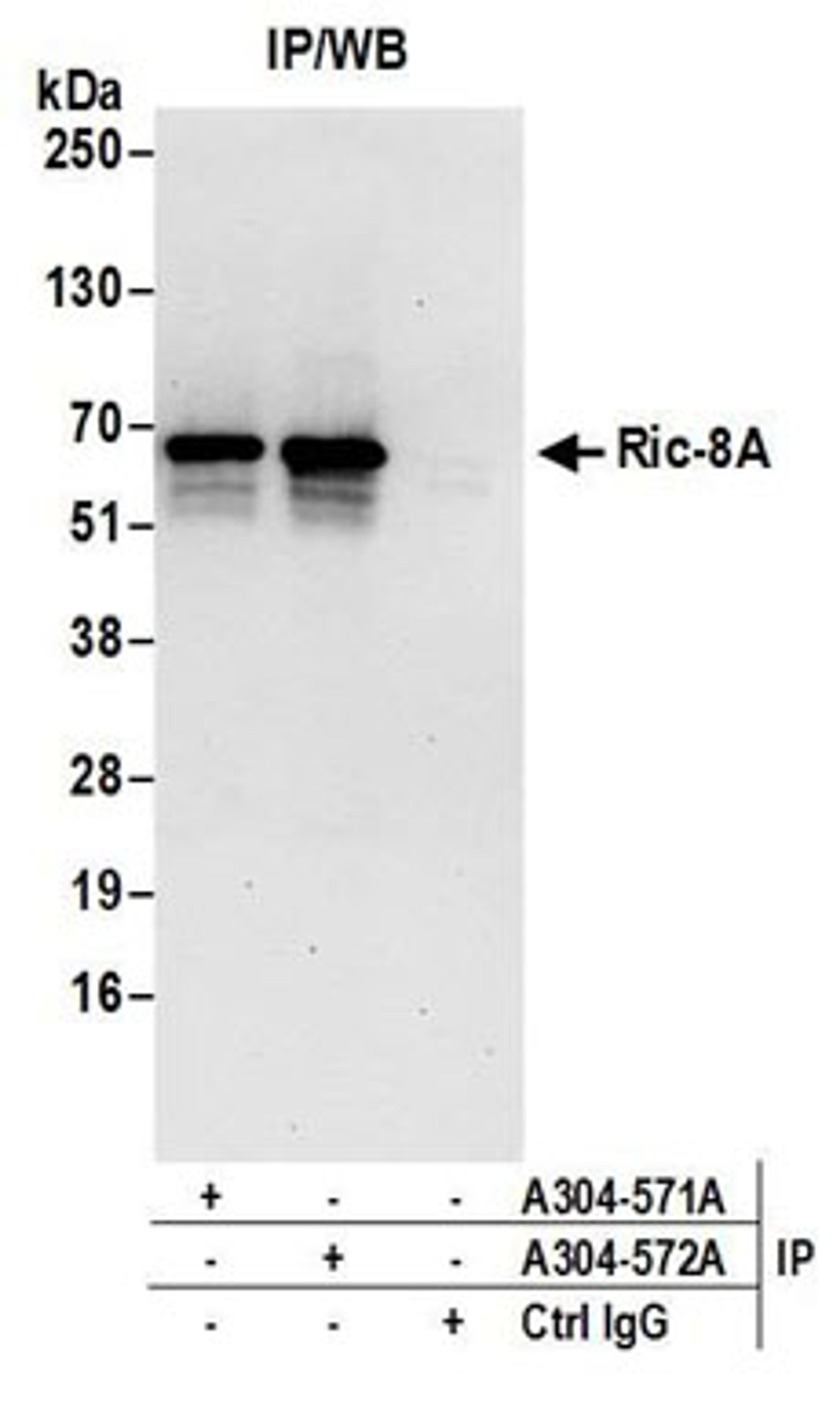 Detection of human Ric-8A by western blot of immunoprecipitates.