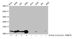 Western Blot. Detected samples: Hela whole cell lysate, A549 whole cell lysate, 293 whole cell lysate, K562 whole cell lysate; Untreated (-) or treated (+) with 10mM sodium propionate for 4h. All lanes: HIST1H4A antibody at 1:100. Secondary. Goat polyclonal to rabbit IgG at 1/50000 dilution. Predicted band size: 12 kDa. Observed band size: 12 kDa