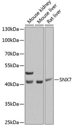 Western blot - SNX7 Antibody (A7805)