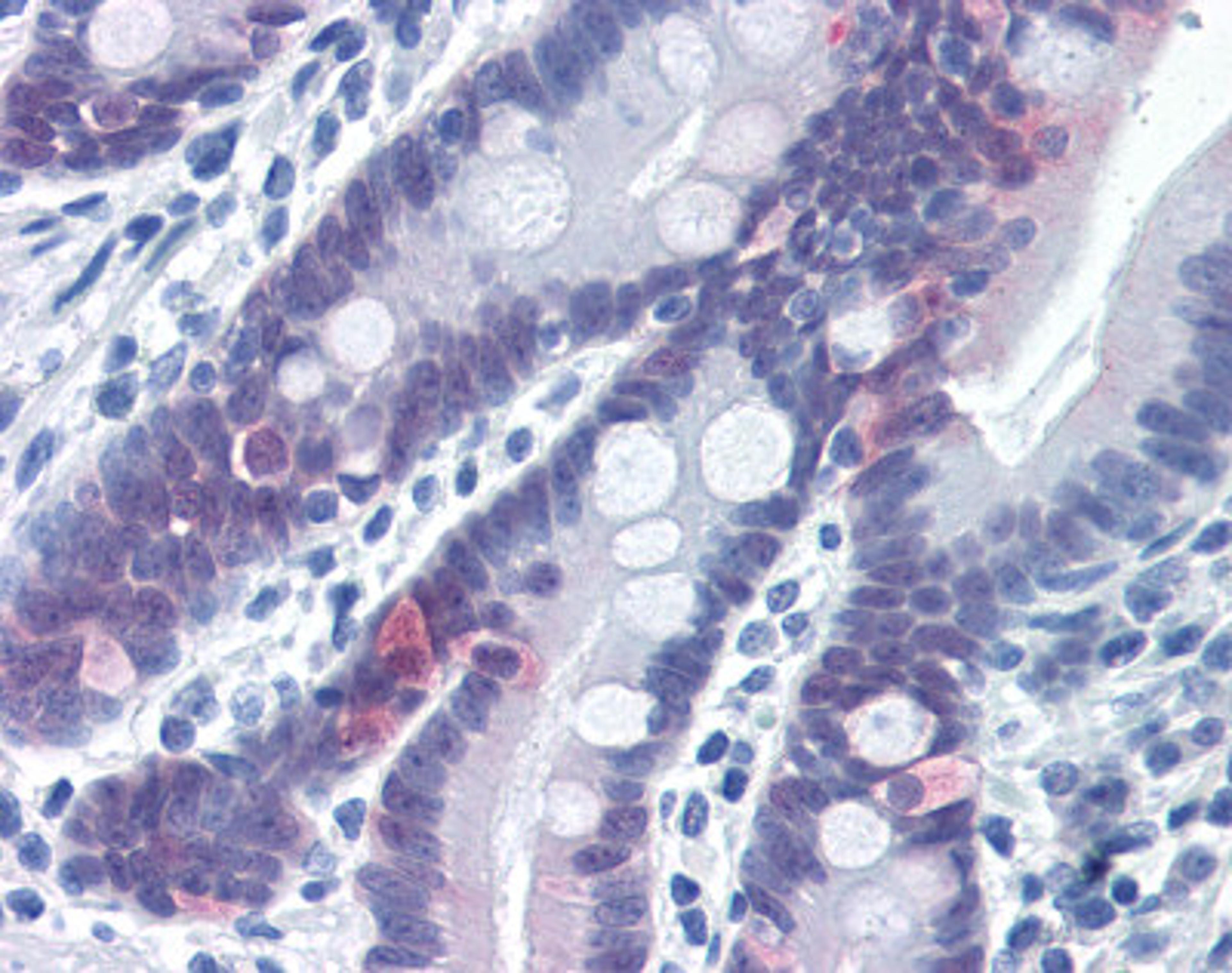 Immunohistochemistry staining of Caspase-6 in small intestine tissue using Caspase-6 Antibody.