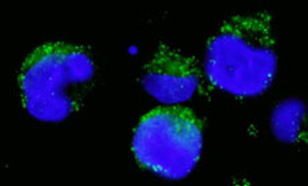 Detection of human BCR by immunocytochemistry.