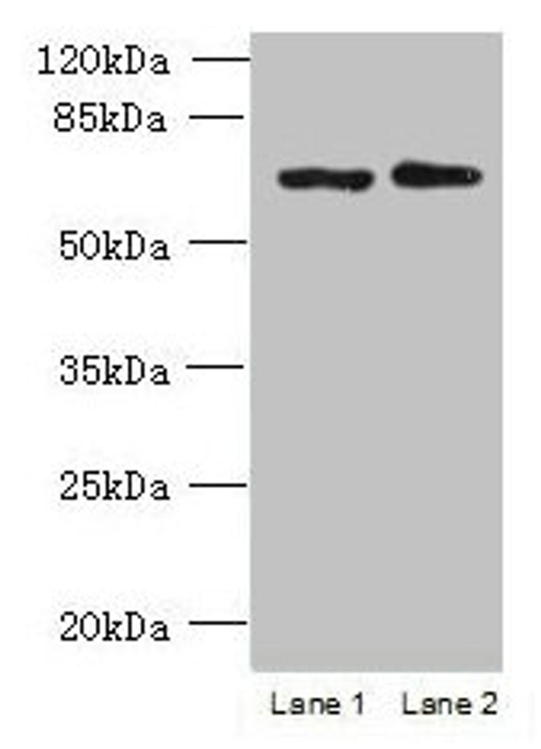 Western blot. All lanes: TBC1D19 antibody at 9µg/ml. Lane 1: U251 whole cell lysate. Lane 2: A375 whole cell lysate. Secondary. Goat polyclonal to rabbit IgG at 1/10000 dilution. Predicted band size: 61, 53 kDa. Observed band size: 61 kDa