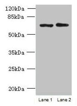 Western blot. All lanes: TBC1D19 antibody at 9µg/ml. Lane 1: U251 whole cell lysate. Lane 2: A375 whole cell lysate. Secondary. Goat polyclonal to rabbit IgG at 1/10000 dilution. Predicted band size: 61, 53 kDa. Observed band size: 61 kDa