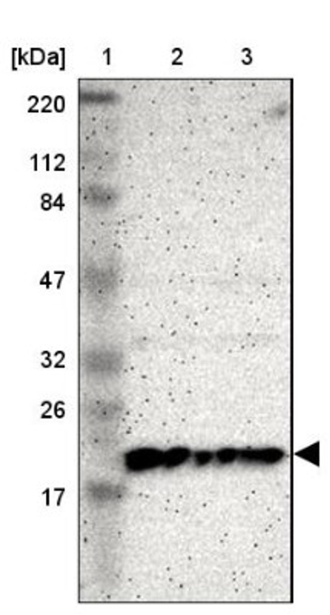 Western Blot: ICT Antibody [NBP1-87963] - Lane 1: Marker [kDa] 220, 112, 84, 47, 32, 26, 17<br/>Lane 2: Human cell line RT-4<br/>Lane 3: Human cell line U-251MG sp