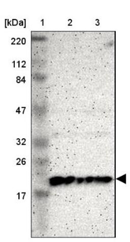 Western Blot: ICT Antibody [NBP1-87963] - Lane 1: Marker [kDa] 220, 112, 84, 47, 32, 26, 17<br/>Lane 2: Human cell line RT-4<br/>Lane 3: Human cell line U-251MG sp