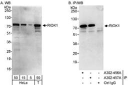 Detection of human RIOK1 by western blot and immunoprecipitation.