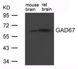 Western blot analysis of extract from Rat brain and Mouse brain Tissue using GAD67 (GAD1).