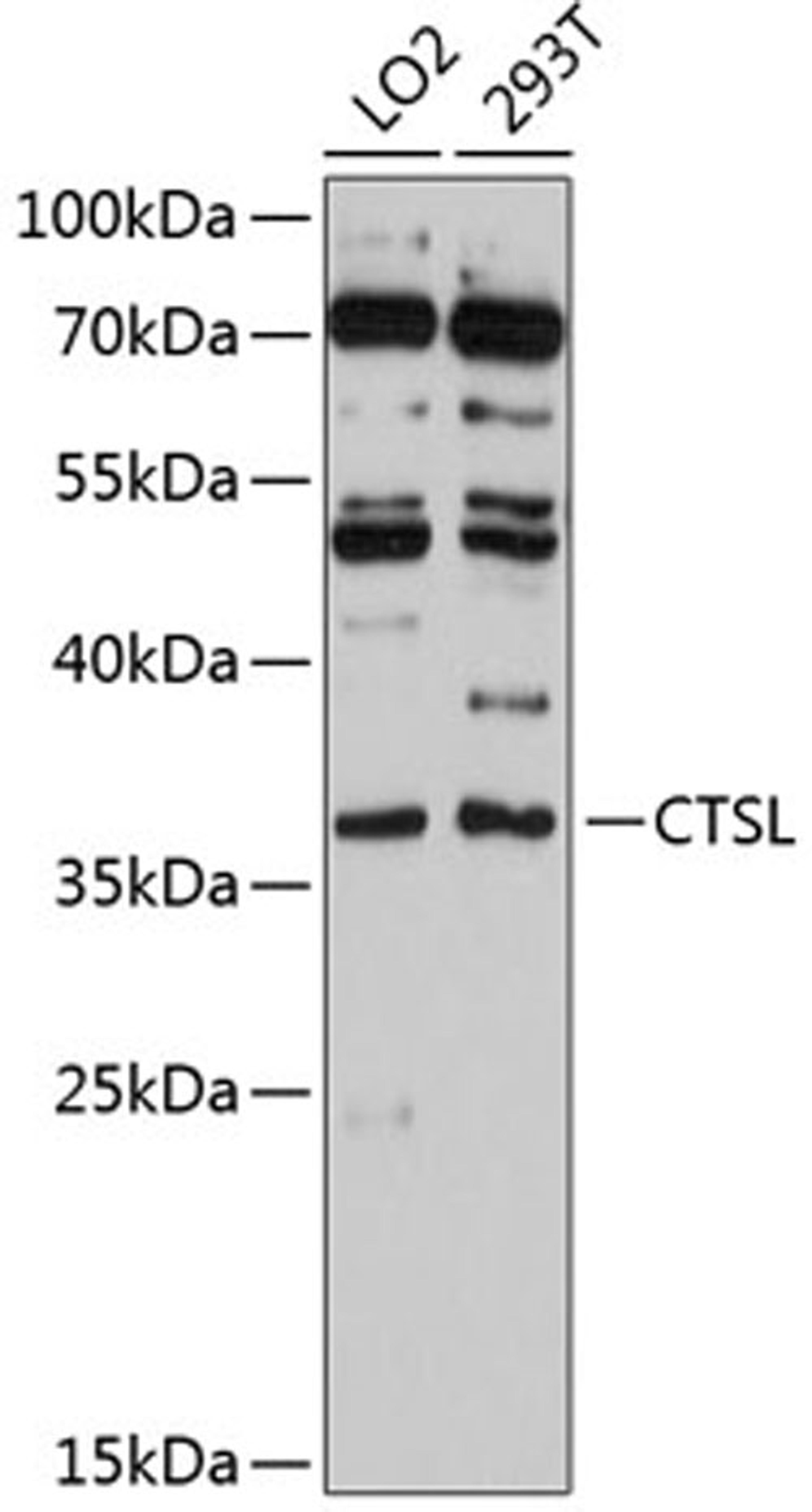 Western blot - CTSL antibody (A12066)