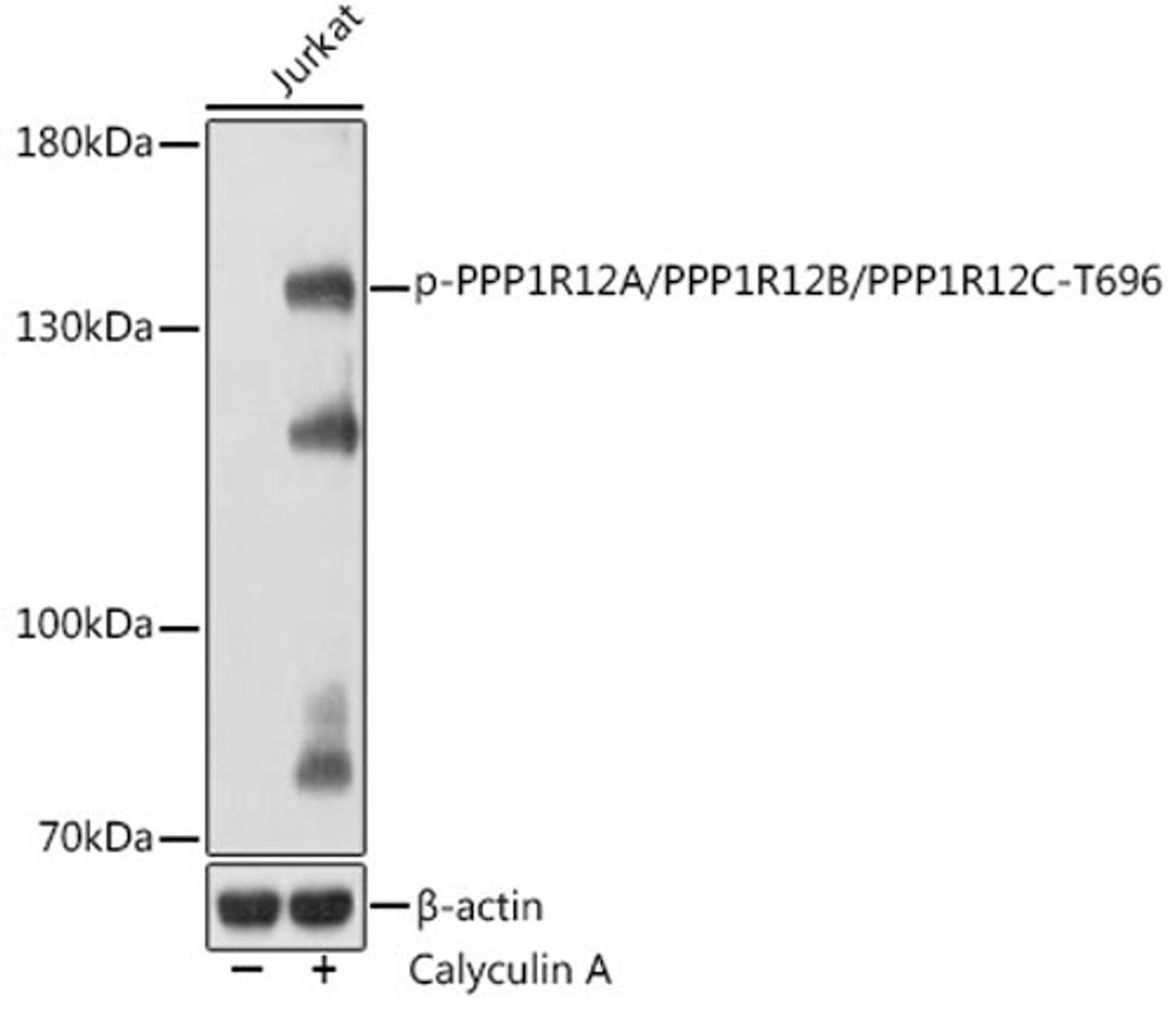 Western blot - Phospho-PPP1R12A/PPP1R12B/PPP1R12C-T696 Rabbit pAb (AP1164)