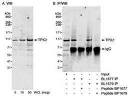 Detection of human TPX2 by western blot and immunoprecipitation.