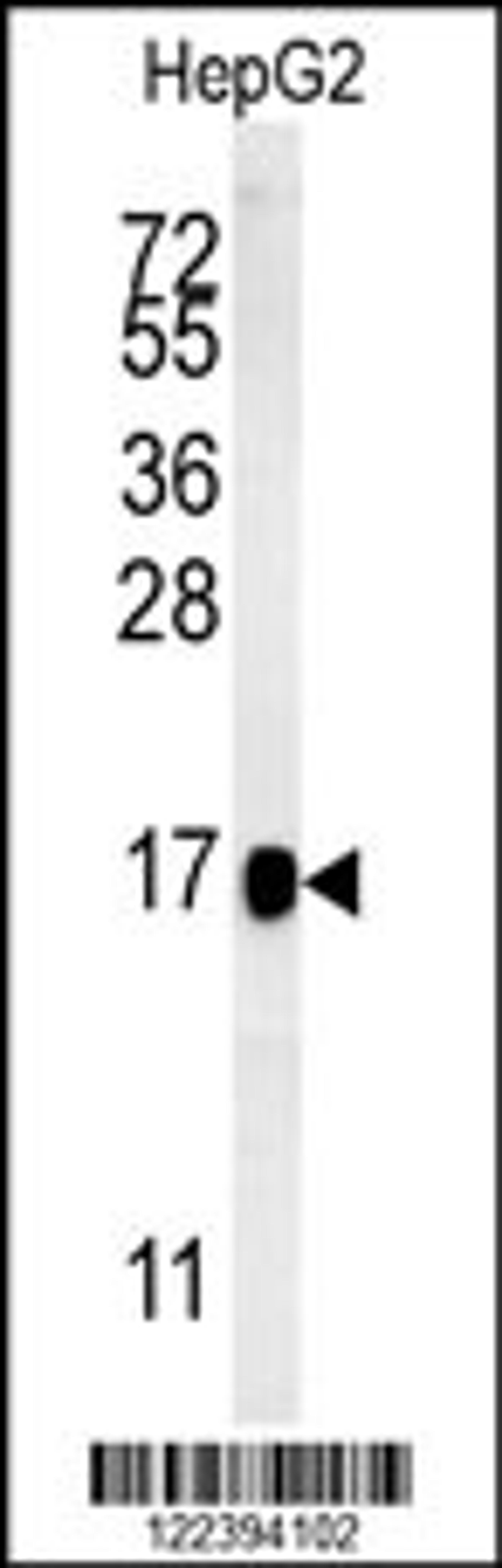 Western blot analysis in HepG2 cell line lysates (15ug/lane).