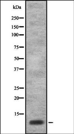 Western blot analysis of HEK293 cells using ISK7 antibody