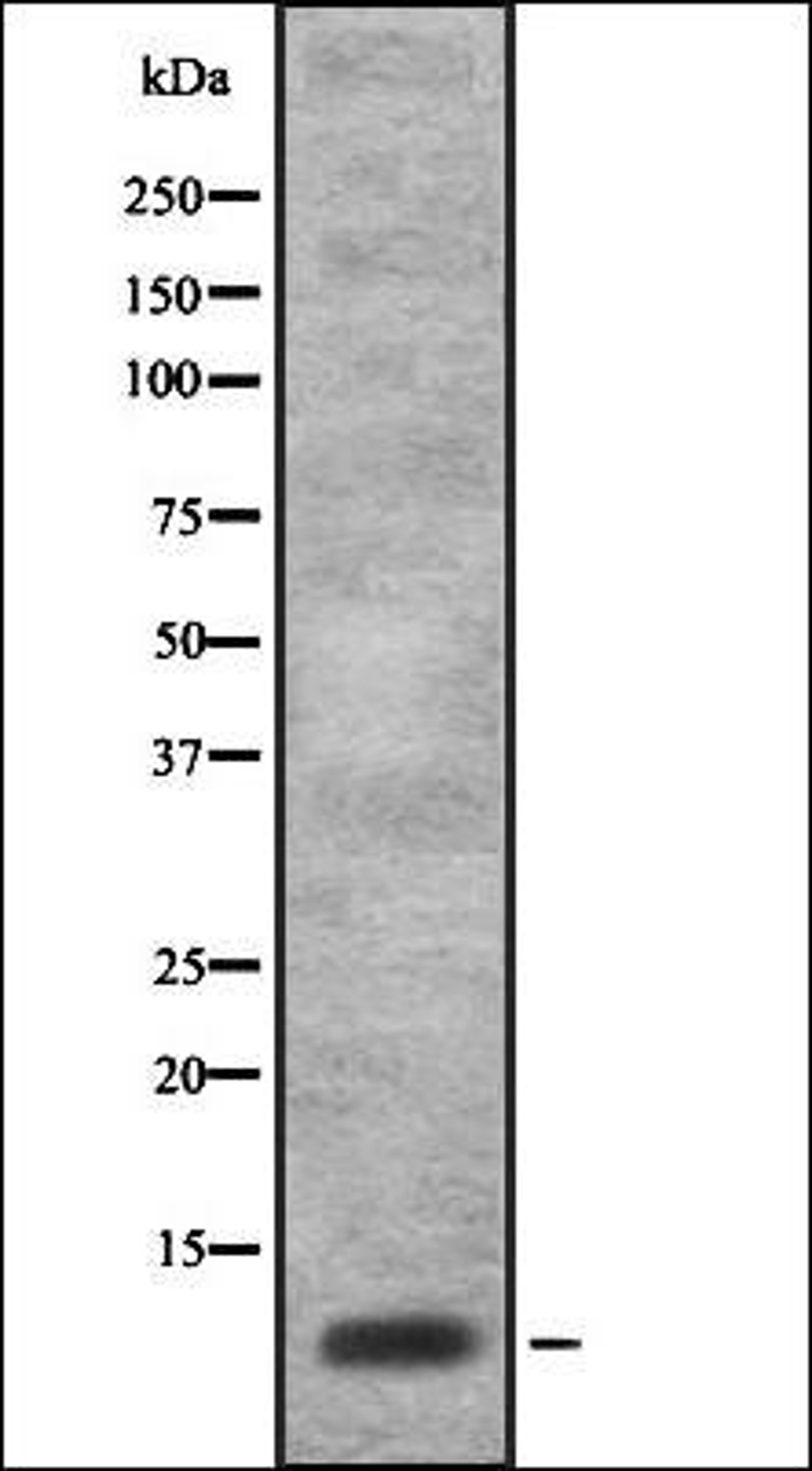 Western blot analysis of HEK293 cells using ISK7 antibody