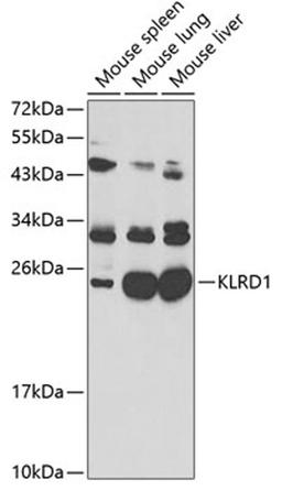 Western blot - KLRD1 antibody (A2039)