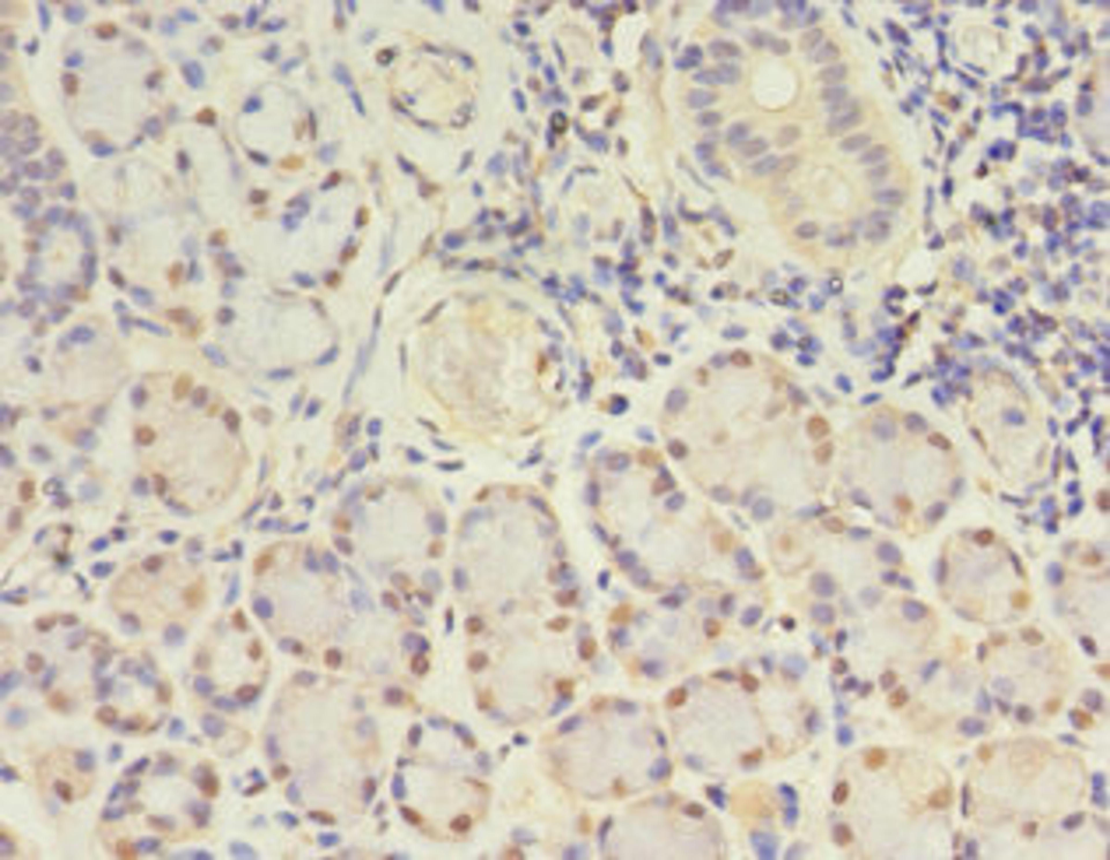 Immunohistochemistry of paraffin-embedded human pancreatic tissue using CSB-PA009455DA01HU at dilution of 1:100