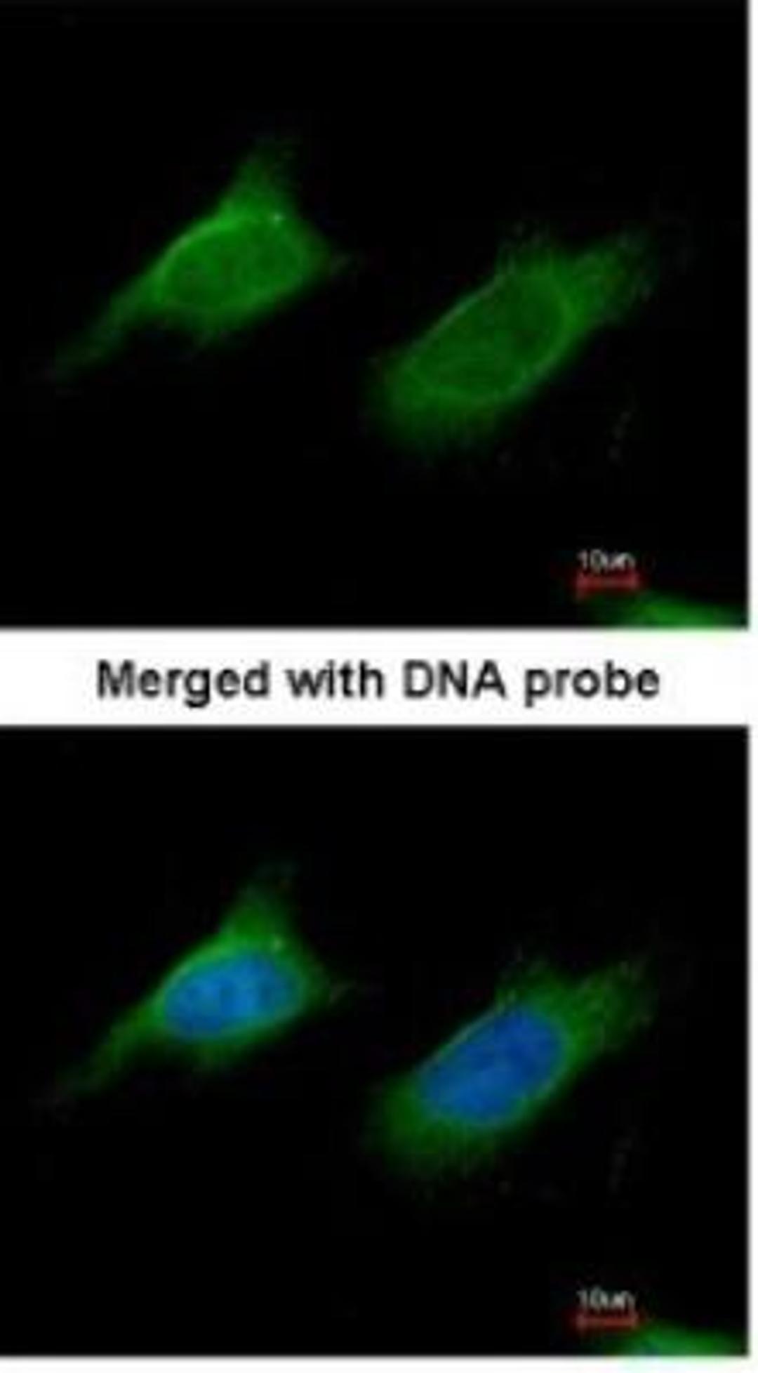 Immunocytochemistry/Immunofluorescence: alpha-N-acetylglucosaminidase/NAGLU Antibody [NBP1-31555] - Paraformaldehyde-fixed HeLa, using antibody at 1:200 dilution.