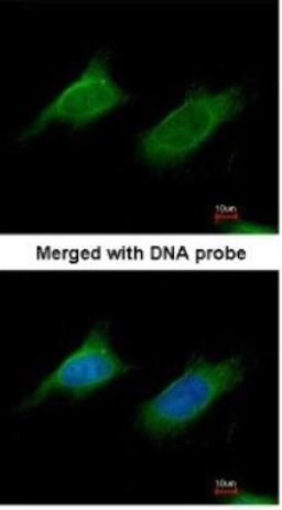 Immunocytochemistry/Immunofluorescence: alpha-N-acetylglucosaminidase/NAGLU Antibody [NBP1-31555] - Paraformaldehyde-fixed HeLa, using antibody at 1:200 dilution.