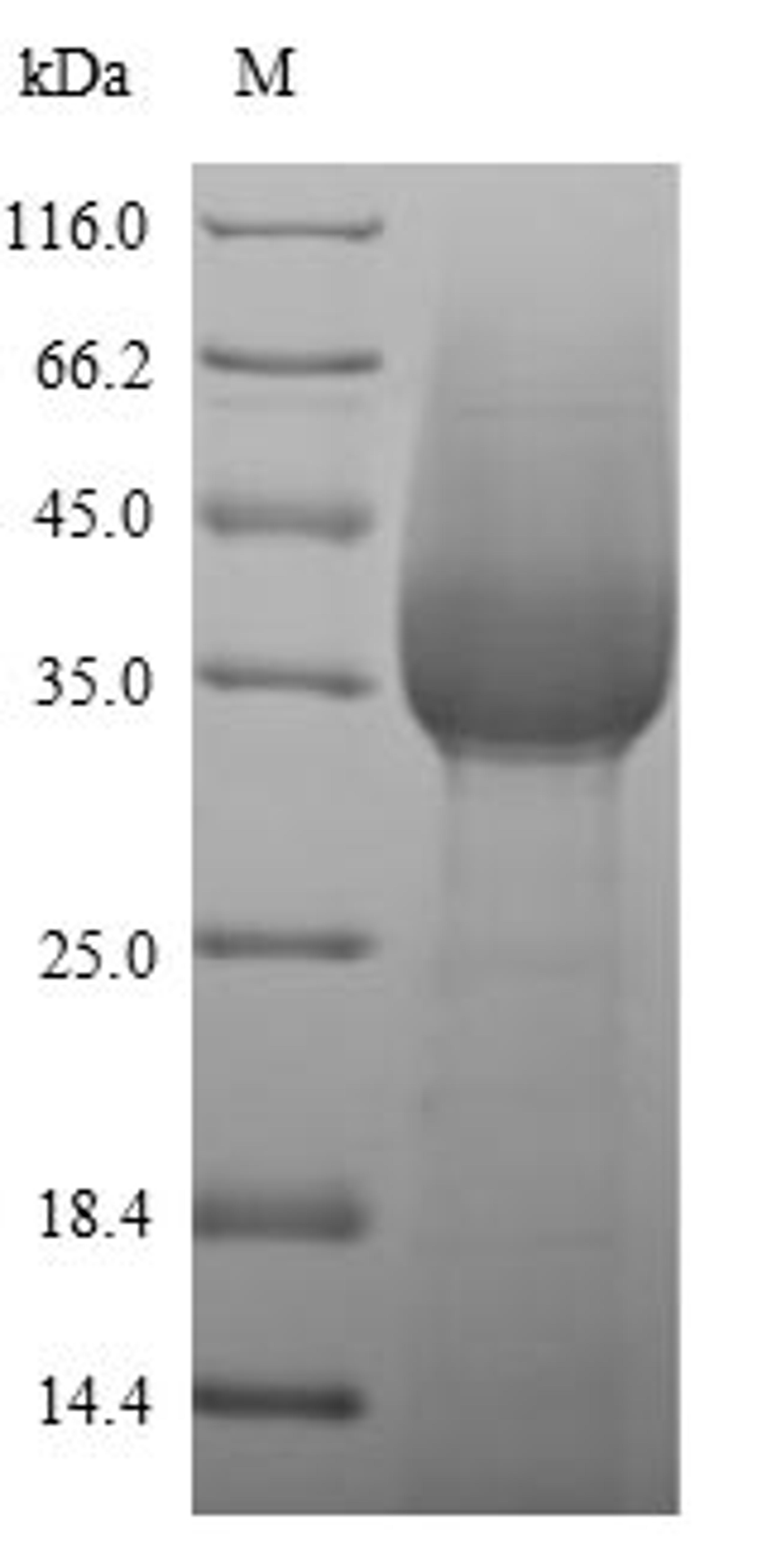 (Tris-Glycine gel) Discontinuous SDS-PAGE (reduced) with 5% enrichment gel and 15% separation gel.