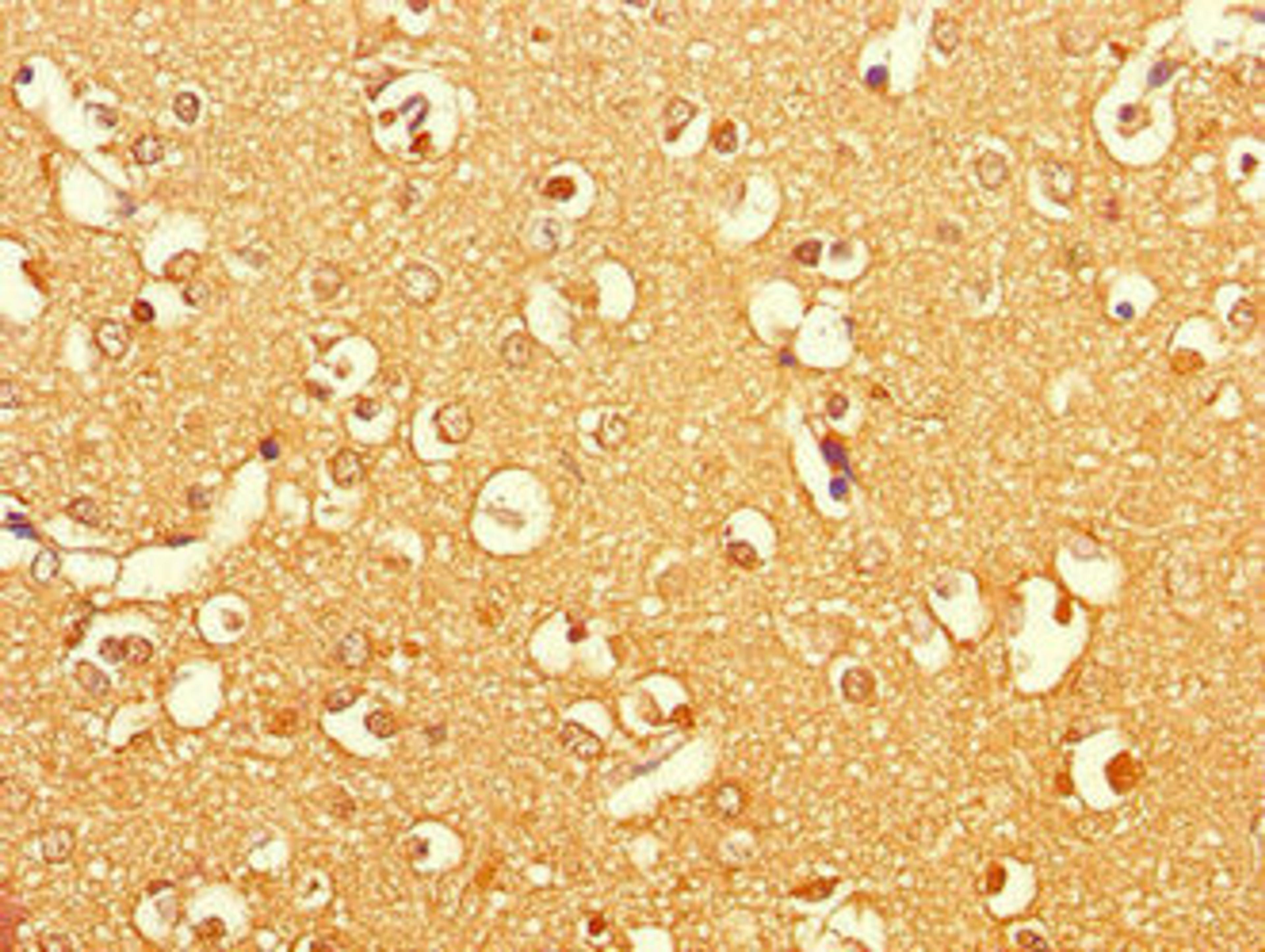 Immunohistochemistry of paraffin-embedded human brain tissue using CSB-PA006515LA01HU at dilution of 1:100