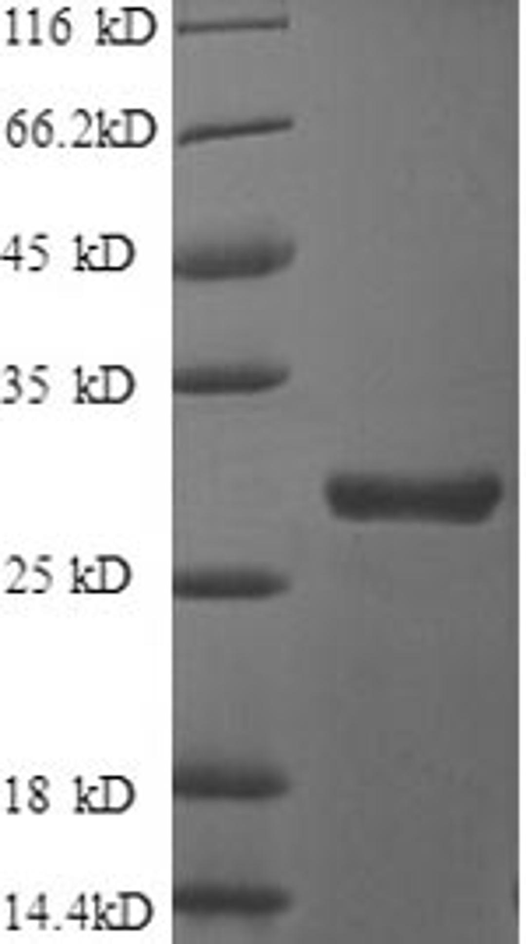(Tris-Glycine gel) Discontinuous SDS-PAGE (reduced) with 5% enrichment gel and 15% separation gel.