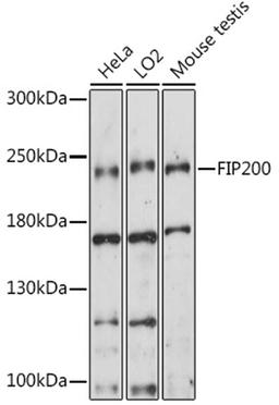 Western blot - FIP200 antibody (A14685)