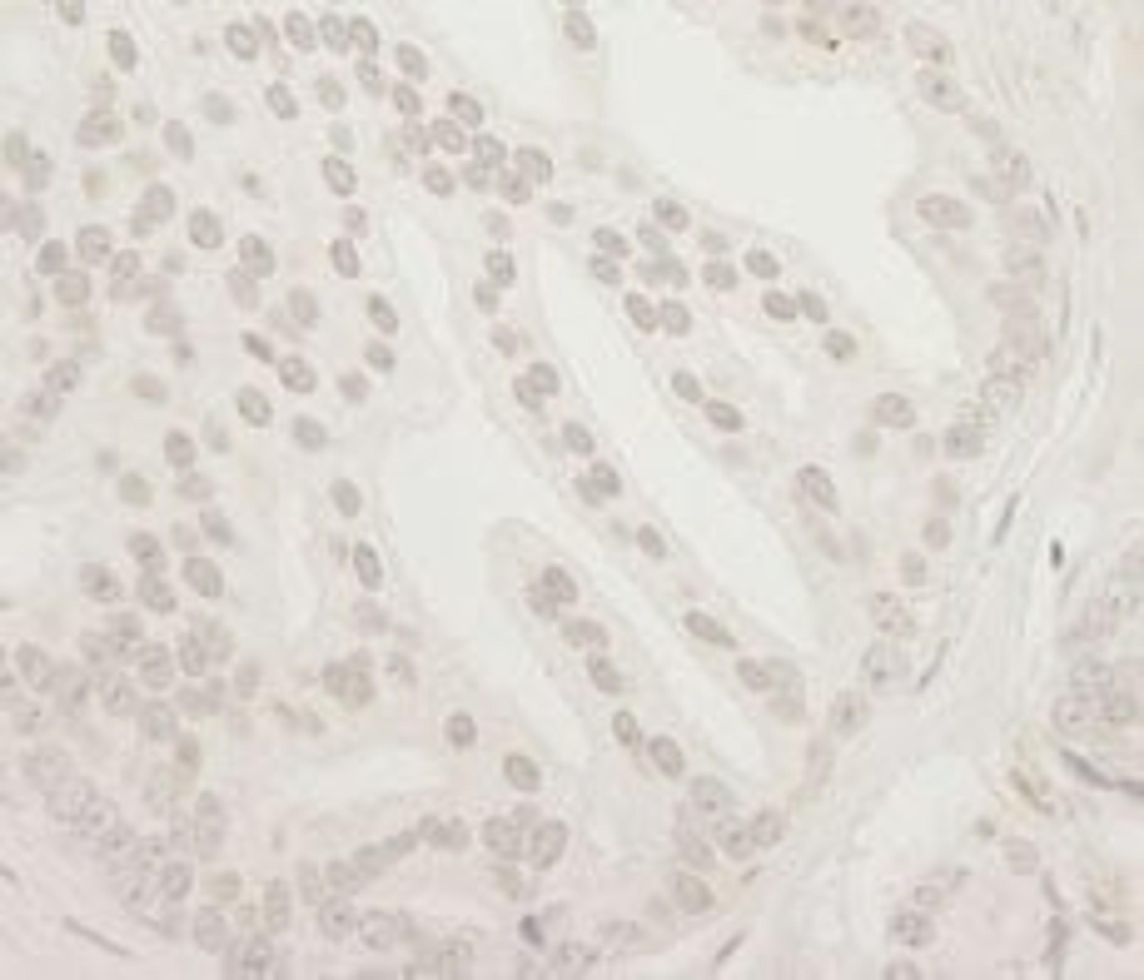 Detection of human USP37 by immunohistochemistry.