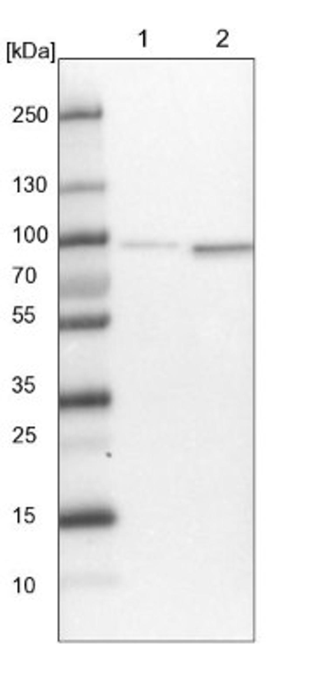 Western Blot: TNIP1 Antibody [NBP1-89306] - Lane 1: NIH-3T3 cell lysate (Mouse embryonic fibroblast cells)<br/>Lane 2: NBT-II cell lysate (Rat Wistar bladder tumour cells)