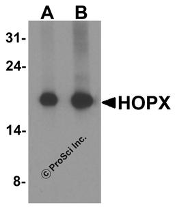 Western blot analysis of HOPX in human brain tissue lysate with HOPX antibody at (A) 1 and (B) 2 μg/ml.