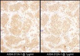 Detection of human GART by immunohistochemistry.