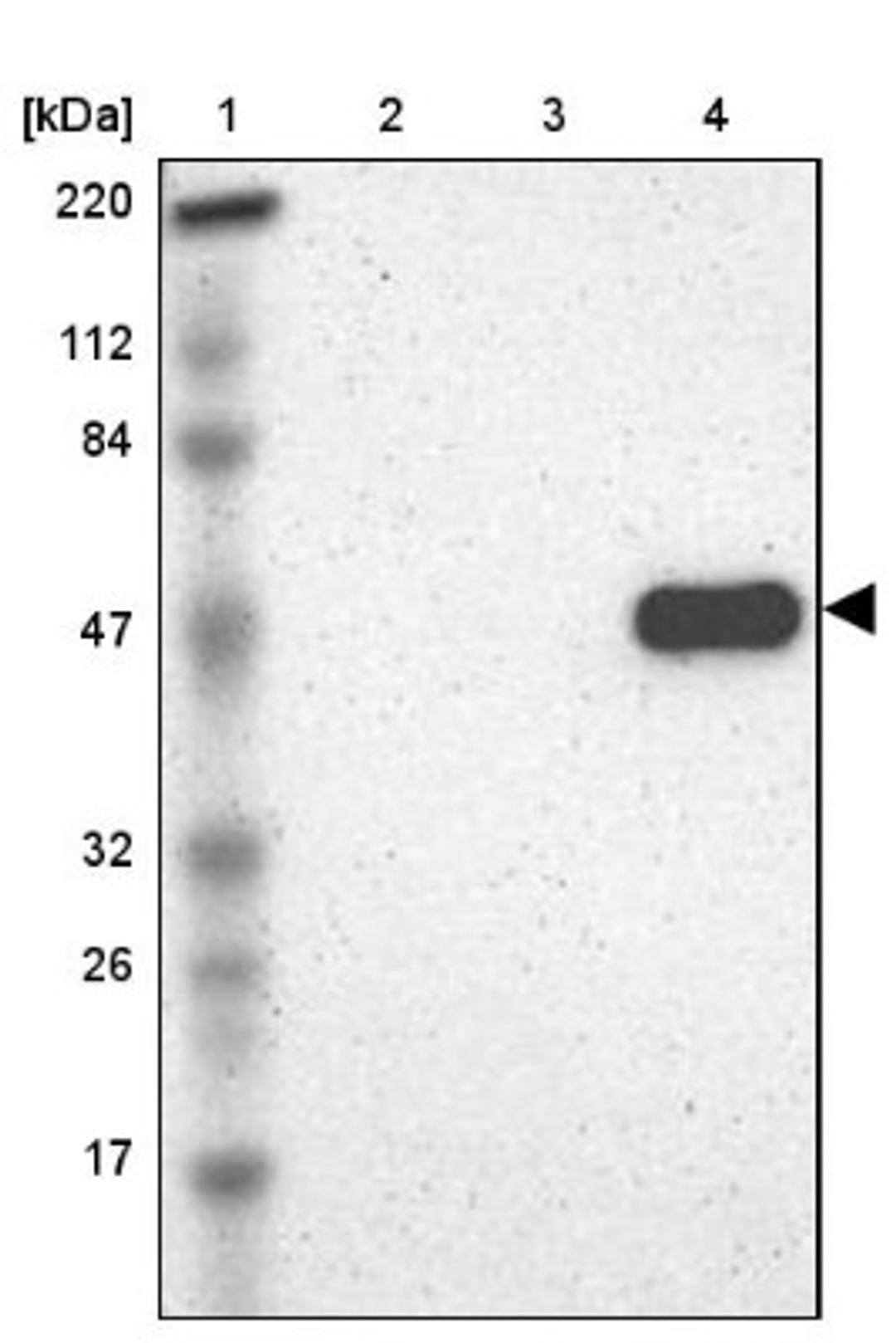 Western Blot: PEDF Antibody [NBP1-83972] - Lane 1: Marker [kDa] 220, 112, 84, 47, 32, 26, 17<br/>Lane 2: Human cell line RT-4<br/>Lane 3: Human cell line U-251MG sp<br/>Lane 4: Human plasma (IgG/HSA depleted)