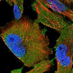 Immunocytochemistry/Immunofluorescence: Platelet Activating Factor Receptor Antibody [NBP1-90346] Staining of human cell line U-251MG shows positivity in nucleus but not nucleoli, plasma membrane & vesicles.