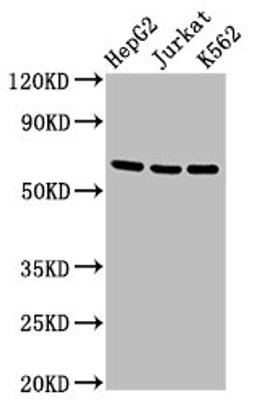 Western Blot. Positive WB detected in: HepG2 whole cell lysate, Jurkat whole cell lysate, K562 whole cell lysate. All lanes: TNFRSF9 antibody at 2.7µg/ml. Secondary. Goat polyclonal to rabbit IgG at 1/50000 dilution. Predicted band size: 28 kDa. Observed band size: 65 kDa