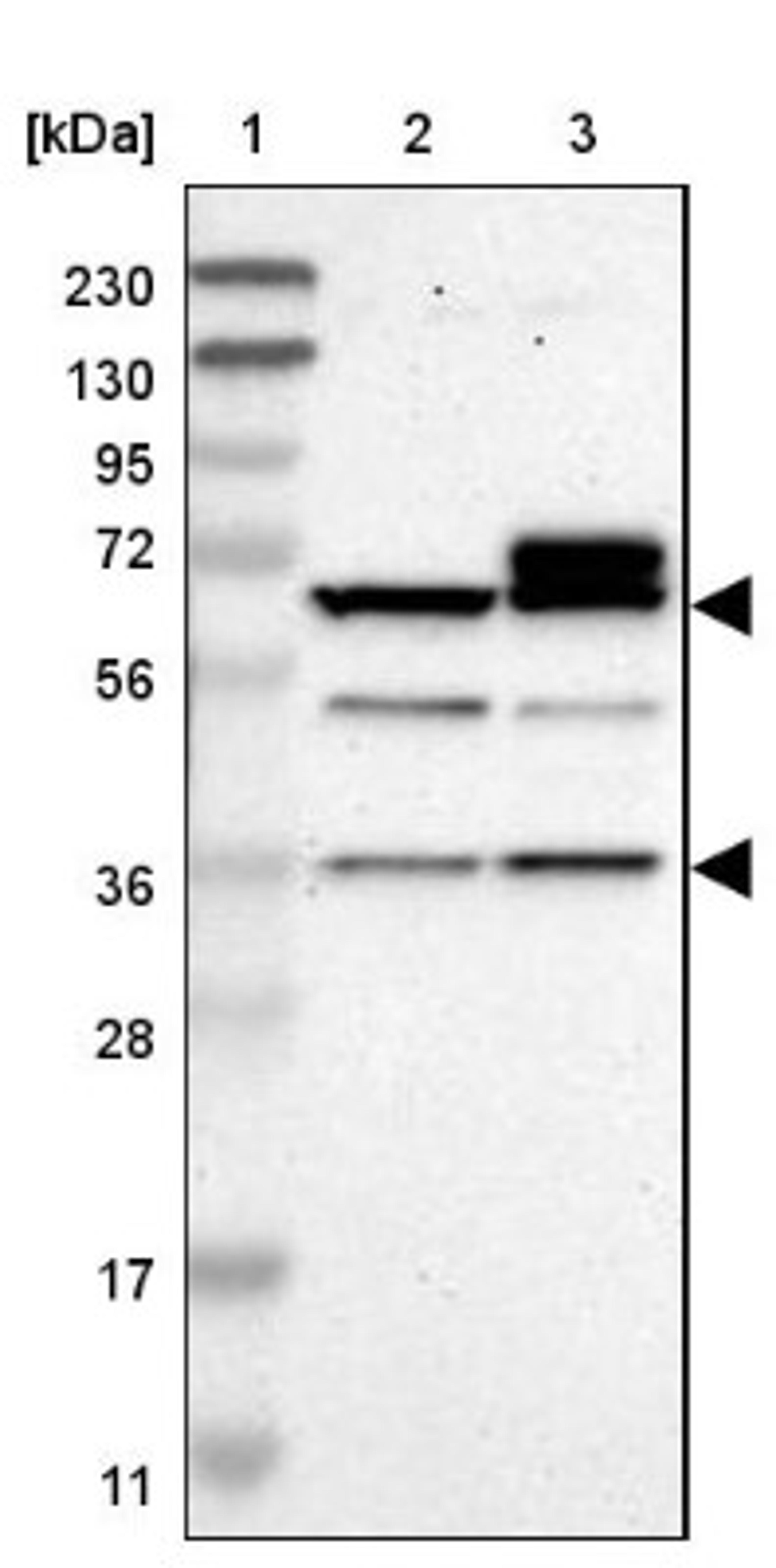 Western Blot: B4GALNT1 Antibody [NBP1-88662] - Lane 1: Marker [kDa] 230, 130, 95, 72, 56, 36, 28, 17, 11<br/>Lane 2: Human cell line RT-4<br/>Lane 3: Human cell line U-251MG sp