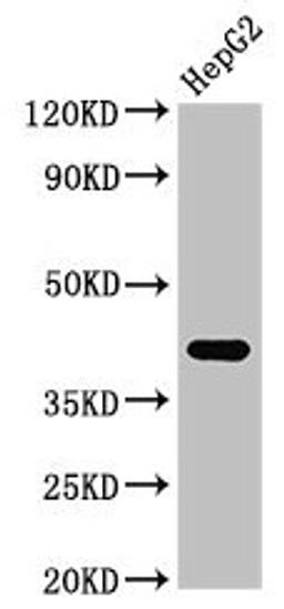 Western Blot. Positive WB detected in: HepG2 whole cell lysate. All lanes: FDPS antibody at 3µg/ml. Secondary. Goat polyclonal to rabbit IgG at 1/50000 dilution. Predicted band size: 49, 41 kDa. Observed band size: 41 kDa