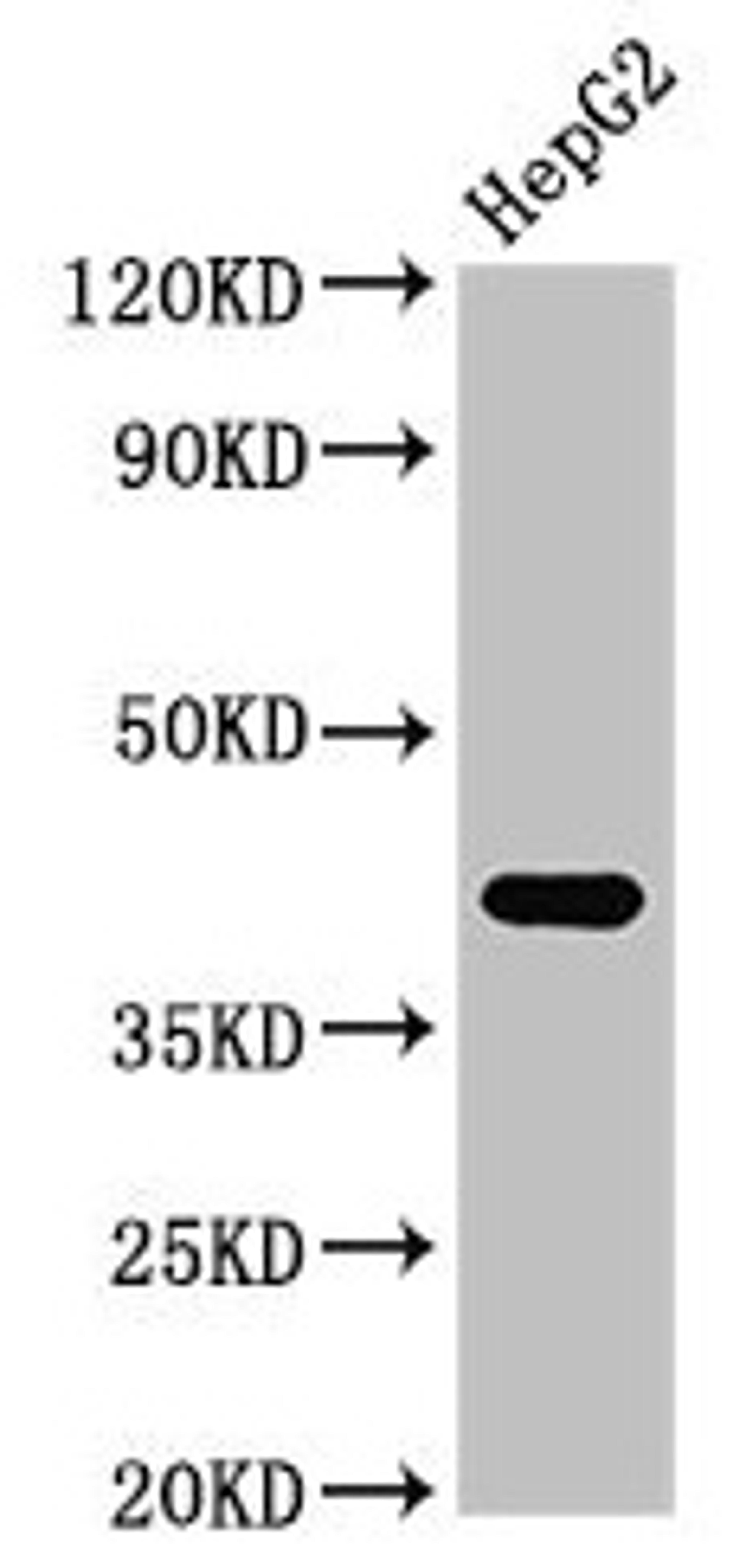 Western Blot. Positive WB detected in: HepG2 whole cell lysate. All lanes: FDPS antibody at 3µg/ml. Secondary. Goat polyclonal to rabbit IgG at 1/50000 dilution. Predicted band size: 49, 41 kDa. Observed band size: 41 kDa