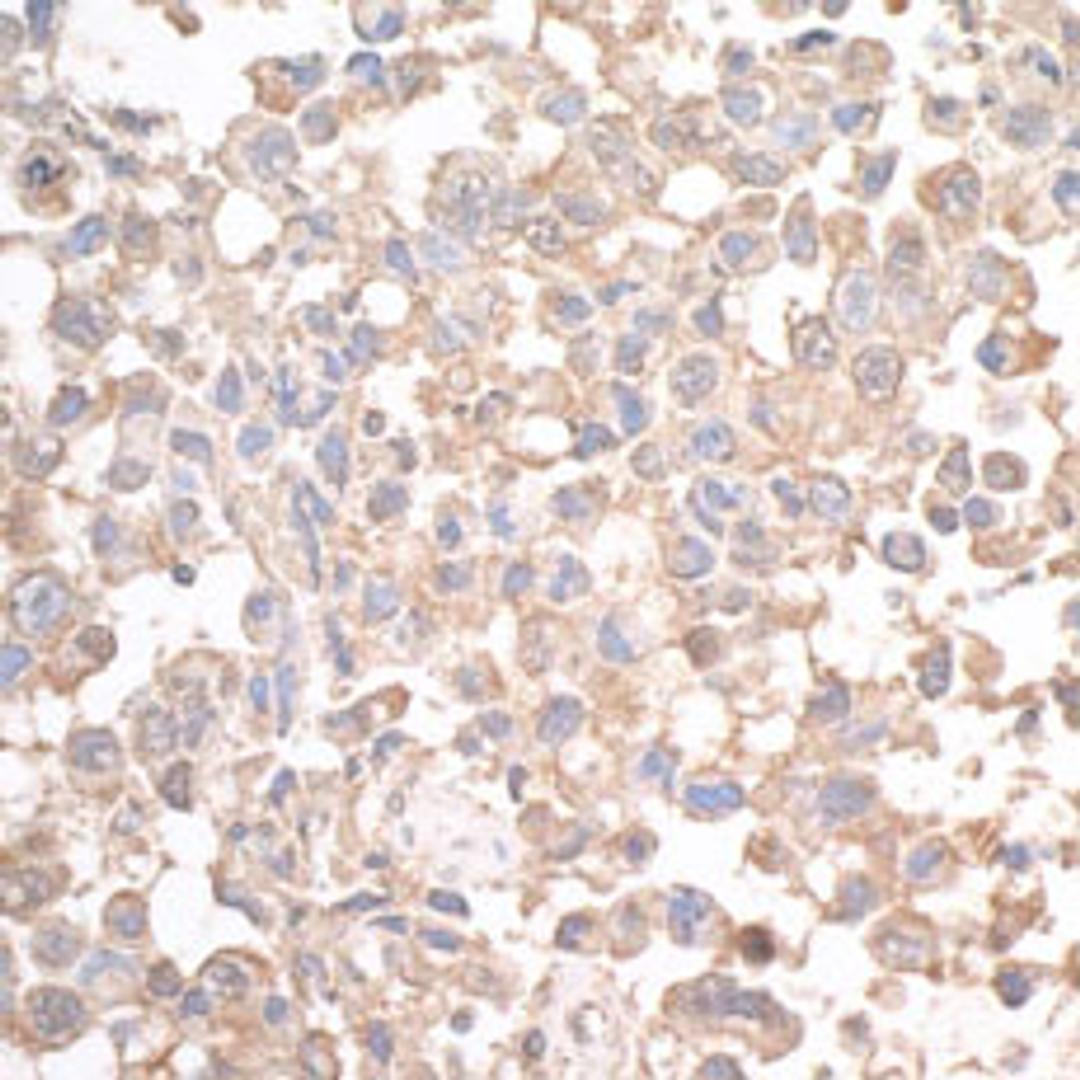 Detection of human JLP by immunohistochemistry.