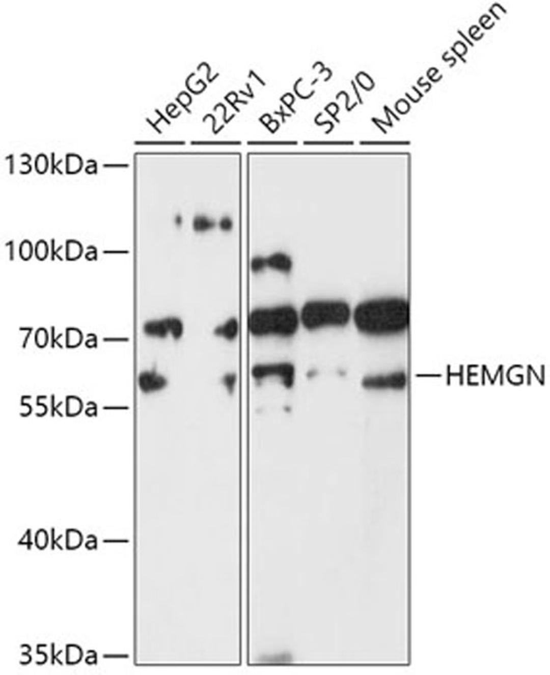 Western blot - HEMGN antibody (A17720)