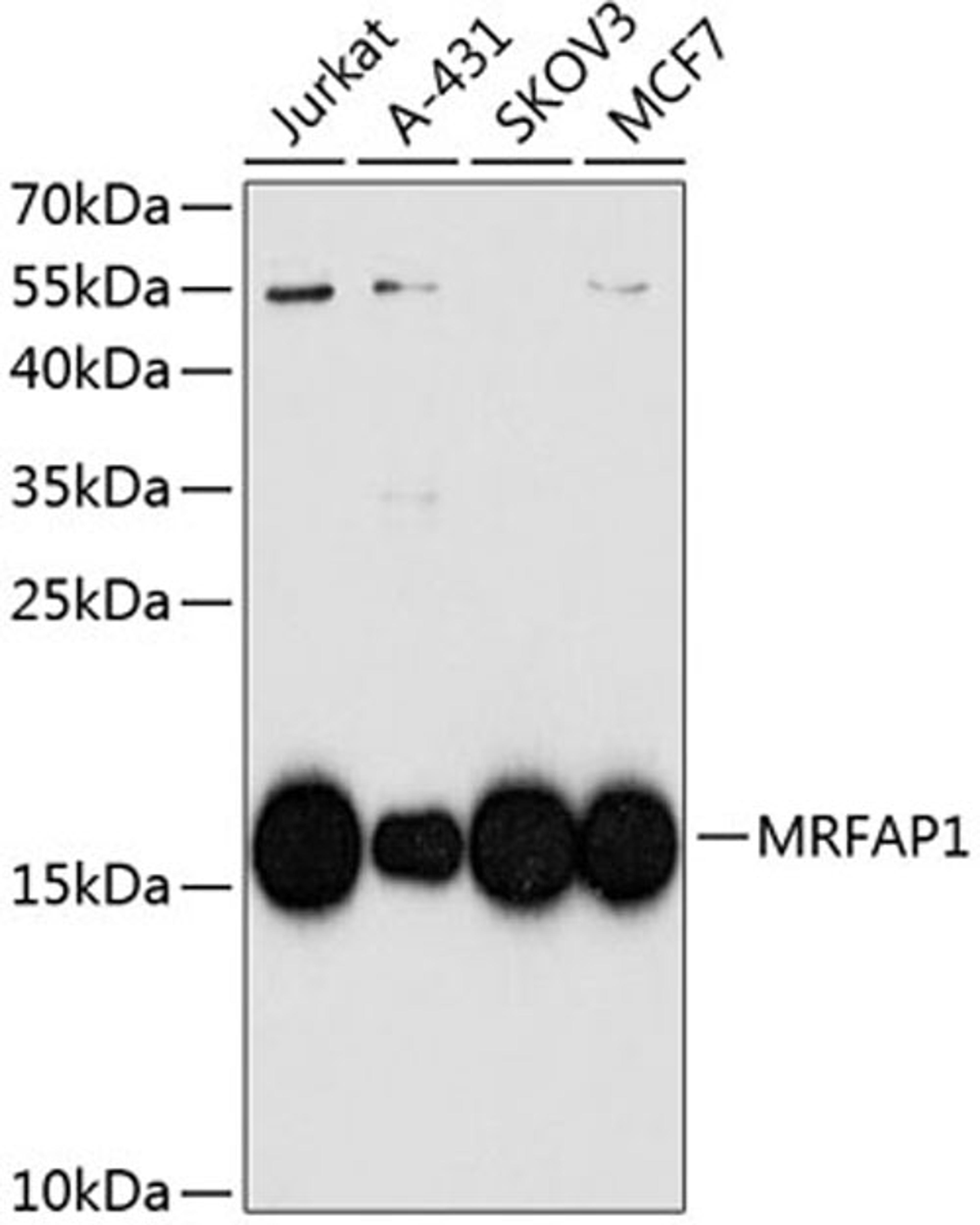 Western blot - MRFAP1 antibody (A8739)