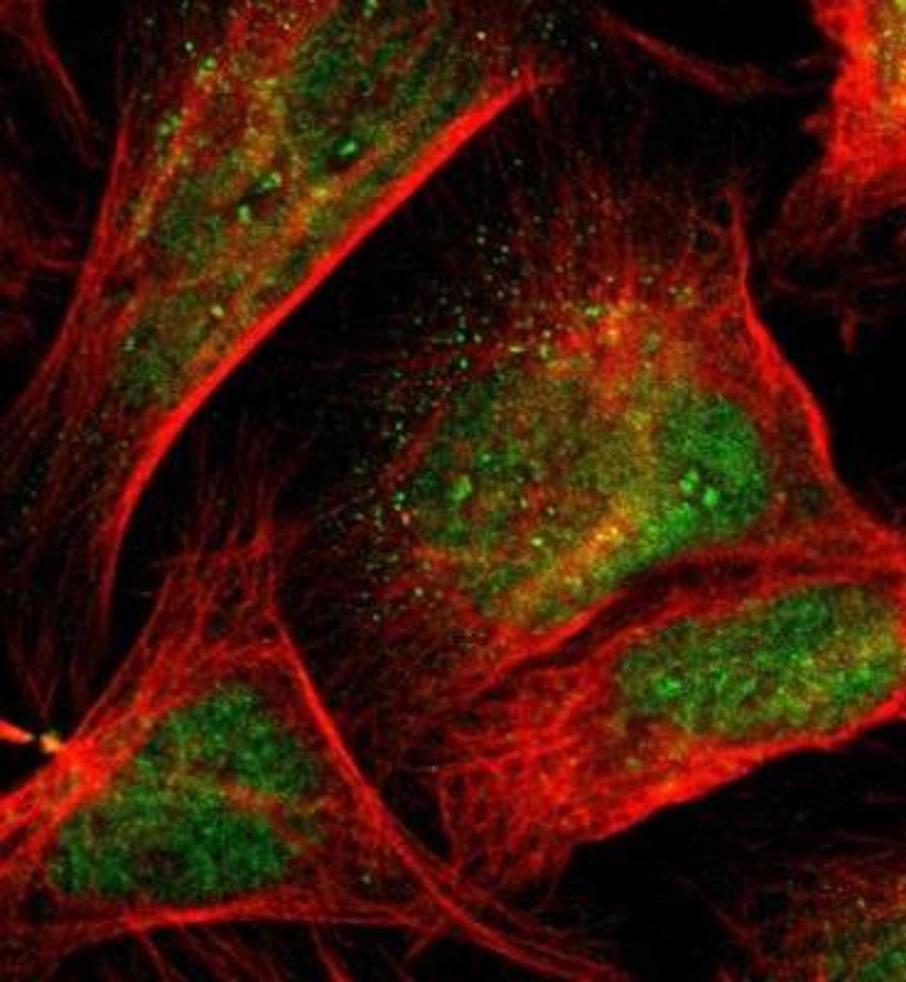 Immunocytochemistry/Immunofluorescence: KDM6A Antibody [NBP1-80628] - Staining of human cell line U-2 OS shows positivity in the Golgi apparatus & nucleus but excluded from the nu