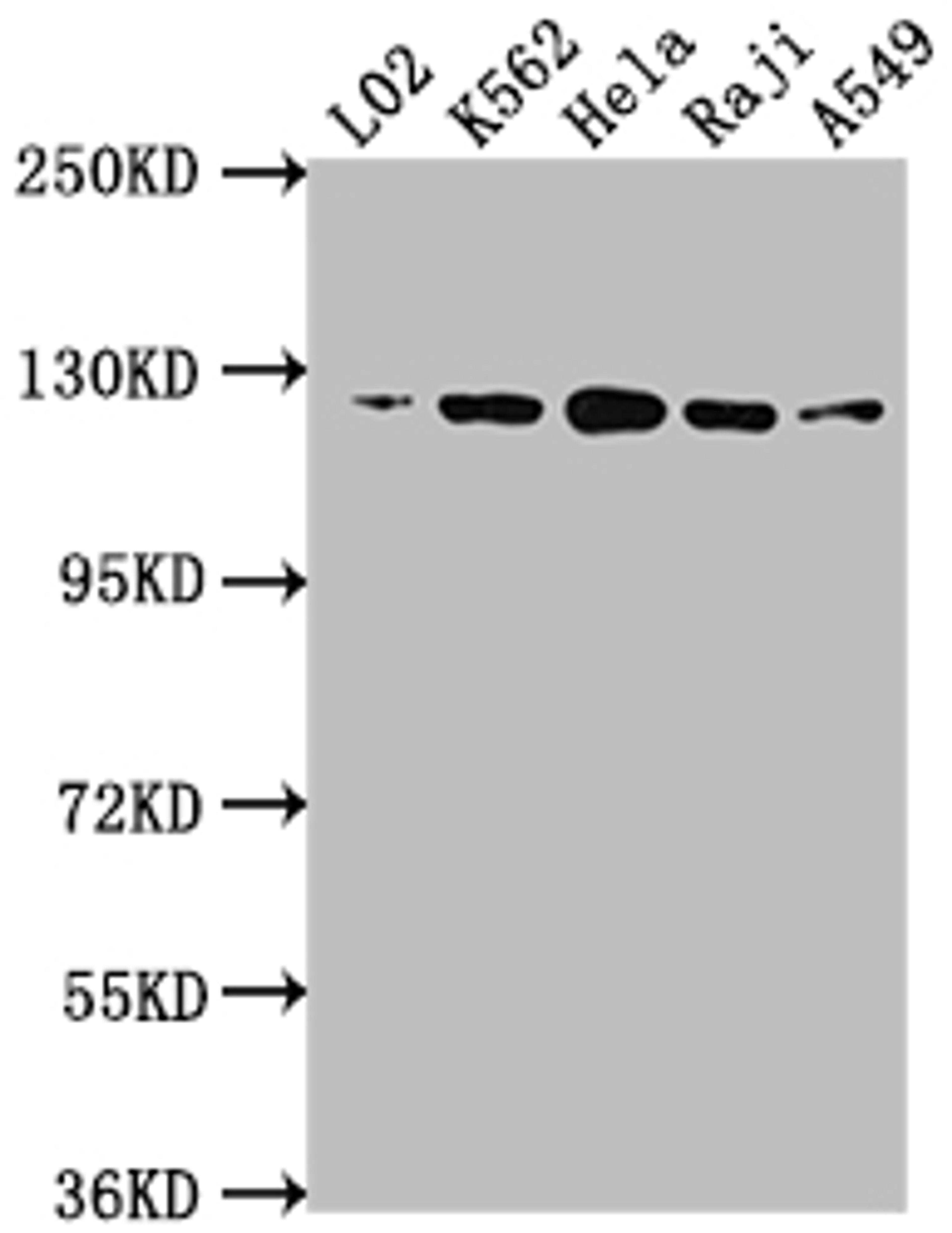 Western Blot. Positive WB detected in: L02 whole cell lysate, K562 whole cell lysate, Hela whole cell lysate, Raji whole cell lysate, A549 whole cell lysate. All lanes: ACLY antibody at 1:1500. Secondary. Goat polyclonal to rabbit IgG at 1/50000 dilution. Predicted band size: 121, 120, 92 kDa. Observed band size: 120 kDa. 