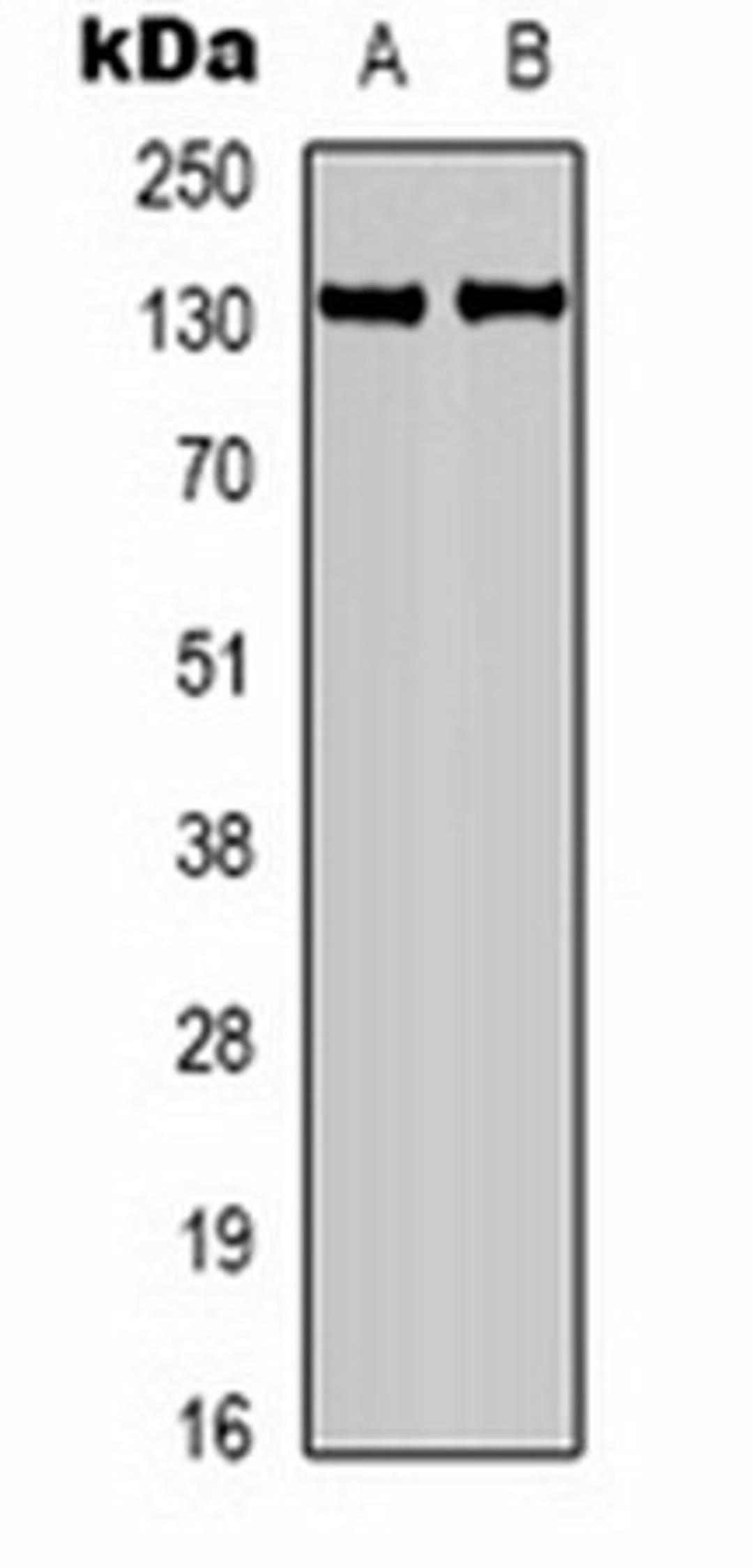 Western blot analysis of mouse brain (Lane 1), rat brain (Lane 2) whole cell lysates using Calcium Sensing Receptor antibody