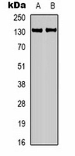 Western blot analysis of mouse brain (Lane 1), rat brain (Lane 2) whole cell lysates using Calcium Sensing Receptor antibody